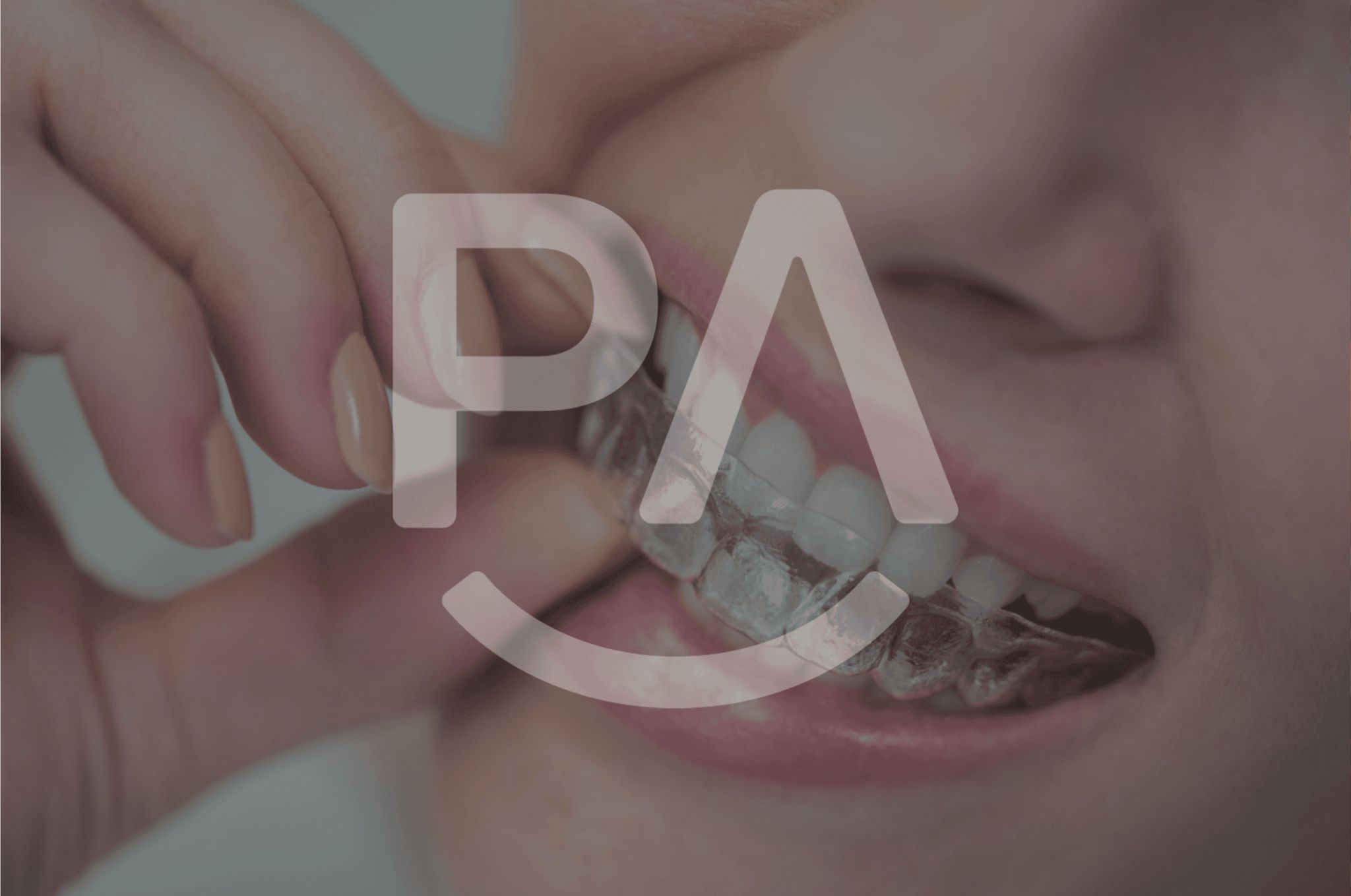 ParisAline Aligners, a discreet solution that’s revolutionizing the way people think about orthodontics. So, how exactly do these aligners make an impact?